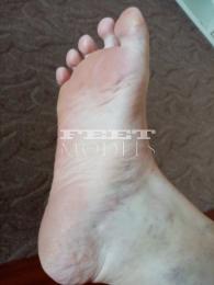 Feet model